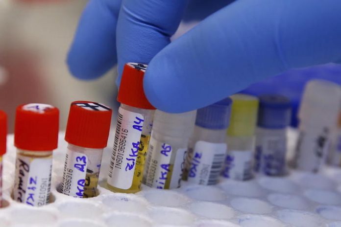Spike in birth defects linked to Zika virus Spike in birth defects linked to Zika virus